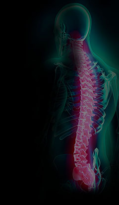 A spine with a fully restored S-Curve